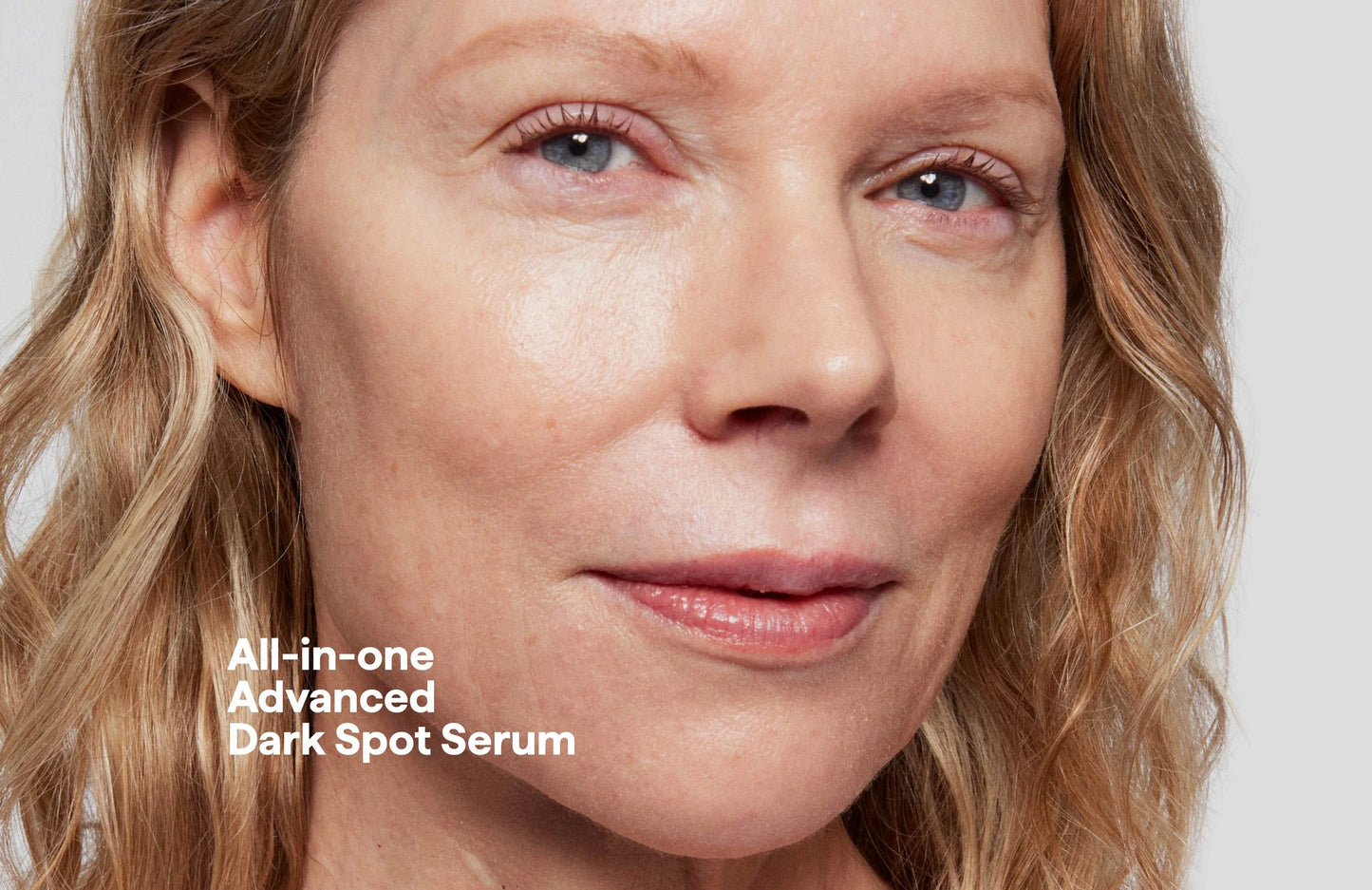 REMEDY darkspots